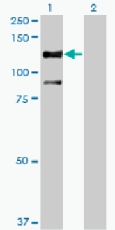 All lanes : Anti-STK31 antibody (ab76839) at 5 µg/mlLane 1 : STK31 transfected 293T cell lysateLane 2 : Non transfected 293T cell lysateLysates/proteins at 25 µg per lane.SecondaryGoat Anti-Mouse IgG (H&L)-HRP Conjugate at 1/2500 dilution