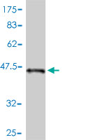 Western blot against tagged recombinant protein immunogen using ab58132 STK32A antibody at 1ug/ml.