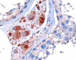 ab26065 (10µg/ml) staining of Human Testis by IHC-P. Microwaved antigen retrieval with Tris/EDTA buffer pH9, HRP-staining.