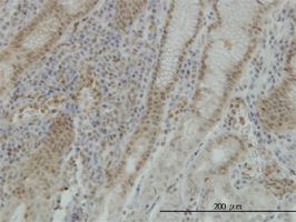 STK38 antibody (ab56977) used in immunohistochemistry at 1ug/ml on formalin fixed and paraffin embedded human stomach.