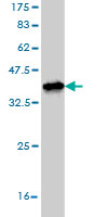 Western blot against tagged recombinant protein immunogen using ab56888 STMN2 antibody at 1ug/ml.
