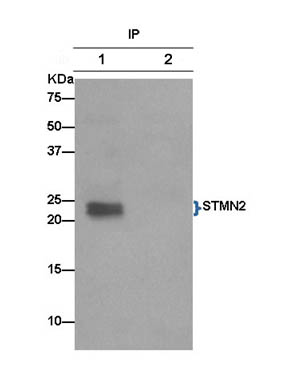 Immunoprecipitation of Human fetal brain lysate labelling STMN2 with ab185943 at 1/50 dilution (Lane 1) compared to control PBS (lane 2). Anti-Rabbit IgG (HRP), specific to the non-reduced form of IgG secondary antibody used at 1/1500 dilution.