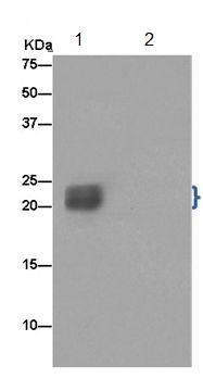 Immunoprecipitation of Human fetal brain lysates using ab185956 (lane 1). Detection of STMN2 utilised ab185956 at 1/50 dilution and Anti-Rabbit IgG (HRP), specific to the non-reduced form of IgG at 1/1500 dilution. The control utilised PBS instead of Human fetal brain lysates (lane 2). Based on the sequence analysis, ab185956 recognizes two isoforms with the predicted MWs of 21KDa and 22KDa, respectively.