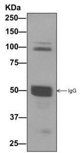 Western blot analysis on immunoprecipitation pellet from Human fetal brain lysate, immunoprecipitated using ab177155 at 1/10 dilution.