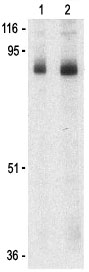 Lane 1 :  Anti-Stromal interaction molecule 1 antibody (ab62031) at 1 µg/mlLane 2 :  Anti-Stromal interaction molecule 1 antibody (ab62031) at 2 µg/mlLane 1 : Mouse thymus tissue lysateLane 2 : Mouse thymus tissue lysateLysates/proteins at 15 µg per lane.