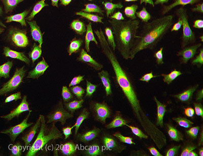 ICC/IF image of ab101222 stained HeLa cells. The cells were 4% formaldehyde fixed (10 min) and then incubated in 1%BSA / 10% normal goat serum / 0.3M glycine in 0.1% PBS-Tween for 1h to permeabilise the cells and block non-specific protein-protein interactions. The cells were then incubated with the antibody ab101222 at 5µg/ml overnight at +4°C. The secondary antibody (green) was DyLight® 488 goat anti- rabbit (ab96899) IgG (H+L) used at a 1/1000 dilution for 1h. Alexa Fluor® 594 WGA was used to label plasma membranes (red) at a 1/200 dilution for 1h. DAPI was used to stain the cell nuclei (blue) at a concentration of 1.43µM. This antibody also gave a positive result in formaldehyde fixed (4%, 10min) Hek293, HepG2, amd MCF-7 cells at 5ug/ml.