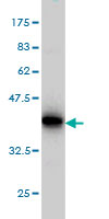 Western blot against tagged recombinant protein immunogen using ab55371 STT3A antibody at 1ug/ml.