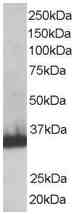 Anti-STUB1 antibody (ab2482) at 1 µg/ml + Human Heart lysate (RIPA buffer, 35ug total protein per lane).
