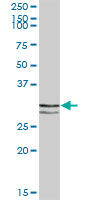 Anti-STX11 antibody (ab69828) at 1/500 dilution + human spleen lysate at 25 µgSecondaryGoat Anti-Mouse IgG (H&L)-HRP Conjugate at 1/2500 dilution