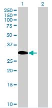 All lanes : Anti-STX19 antibody (ab72678) at 1/500 dilutionLane 1 : STX19 transfected 293T lysateLane 2 : Non-transfected 293T lysateLysates/proteins at 25 µg per lane.SecondaryGoat Anti-Mouse IgG (H&L)-HRP Conjugate at 1/2500 dilution
