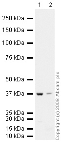 All lanes : Anti-Signal peptide peptidase-like 2B antibody (ab43856) at 1 µg/mlLane 1 : WI38 (Human lung fibroblast cell line) Whole Cell Lysate (ab3960)Lane 2 : Thymus (Human) Tissue Lysate - adult normal tissue (ab30146)Lysates/proteins at 10 µg per lane.SecondaryGoat polyclonal to Rabbit IgG - H&L - Pre-Adsorbed (HRP) at 1/3000 dilutionPerformed under reducing conditions.