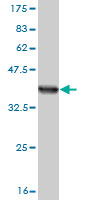Western blot against tagged recombinant protein immunogen using ab58165 SLC15A1 antibody at 1ug/ml. 