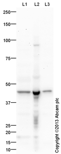 All lanes : Anti-SUCLA2 antibody (ab133956) at 1/250 dilutionLane 1 : Heart (Human) Tissue Lysate - adult normal tissueLane 2 : Human Heart Mitochondrial LysateLane 3 : Heart (Mouse) Tissue LysateLysates/proteins at 10 µg per lane.SecondaryGoat Anti-Rabbit IgG H&L (HRP) (ab97051) at 1/10000 dilutiondeveloped using the ECL techniquePerformed under reducing conditions.