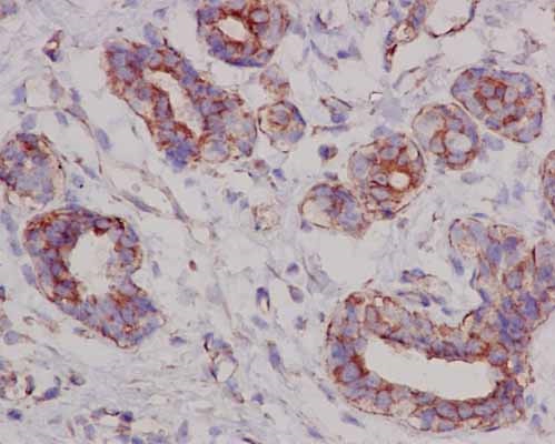 Immunohistochemical analysis of paraffin-embedded Human breast tissue labeling SUCLA2 using ab183513 at a 1/250 dilution, using a HRP Polymer for Rabbit IgG secondary antibody and counterstained with Hematoxylin.