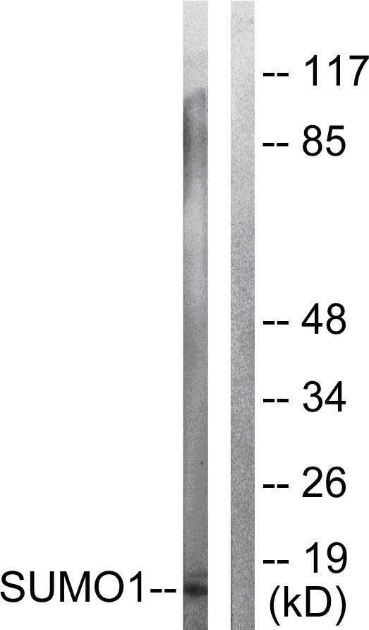 All lanes : Anti-Sumo 1 antibody (ab58424) at 1/500 dilutionLane 1 : 293 cell extractLane 2 : 293 cell extract with immunizing peptide at 5 µgLysates/proteins at 5 µg per lane.SecondaryAnti-Rabbit IgG 