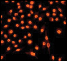 Immunofluorescent staining of HeLa cells using anti-SUMO 1 (ab32058) diluted 1/250.