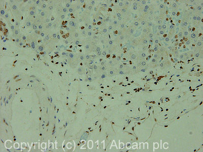 IHC image of ab22654 staining in human normal liver formalin fixed paraffin embedded tissue section, performed on a Leica BondTM system using the standard protocol F. The section was pre-treated using heat mediated antigen retrieval with sodium citrate buffer (pH6, epitope retrieval solution 1) for 20 mins. The section was then incubated with ab22654, 1µg/ml, for 15 mins at room temperature and detected using an HRP conjugated compact polymer system. DAB was used as the chromogen. The section was then counterstained with haematoxylin and mounted with DPX.For other IHC staining systems (automated and non-automated) customers should optimize variable parameters such as antigen retrieval conditions, primary antibody concentration and antibody incubation times.