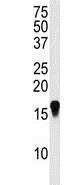 Anti-SUMO4 antibody (ab170850) at 1/100 dilution + HepG2 cell line lysate at 35 µg