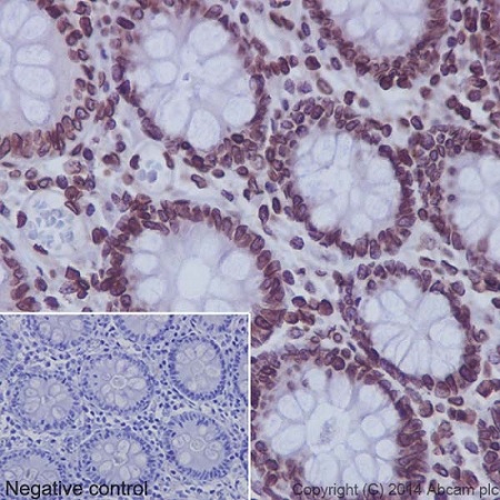 ab124916 staining SUN2 in Human colon tissue sections by Immunohistochemistry (IHC-P - paraformaldehyde-fixed, paraffin-embedded sections). Tissue was fixed and paraffin-embedded, antigen retrieval was by heat mediation in Tris/EDTA buffer pH9. Samples were incubated with primary antibody (1/500). An HRP-conjugated Goat anti-rabbit IgG, ab97051 (1/500), was used as the secondary antibody. Tissue counterstained with Hematoxylin. PBS was used in the negative control rather than the Primary antibody.