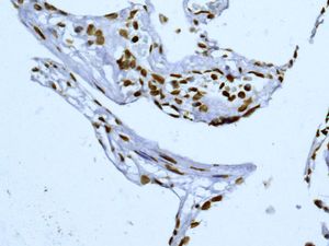 ab124916, unpurified, at a 1/250 dilution, staining SUN2 in paraffin embedded Human lung tissue by Immunohistochemistry.