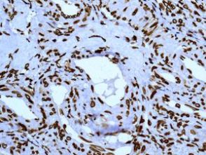ab124916, unpurified, at a 1/250 dilution, staining SUN2 in paraffin embedded Human ovarian tissue by Immunohistochemistry.