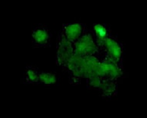 Immunofluorescent analysis of paraformaldehyde-fixed HepG2 cells labeling SUNC1 with ab181063 at 1/100 dilution. A Goat anti rabbit IgG (Alexa Fluor®488) was used as the secondary at 1/200 dilution.