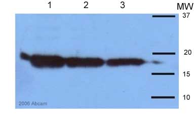 All lanes : Anti-Superoxide Dismutase 1 antibody (ab16831) at 1/2000 dilutionLane 1 : 40ug mouse liver homogenateLane 2 : 20ug mouse liver homogenateLane 3 : 5ug mouse liver homogenateSecondaryHRP conjugated donkey anti-rabbit IgGdeveloped using the ECL techniquePerformed under reducing conditions.