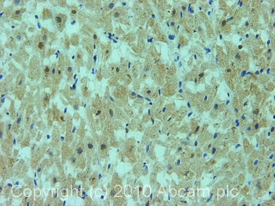 IHC image of ab28442 staining in human heart formalin fixed paraffin embedded tissue section, performed on a Leica BondTM system using the standard protocol F. The section was pre-treated using heat mediated antigen retrieval with sodium citrate buffer (pH6, epitope retrieval solution 1) for 20 mins. The section was then incubated with ab28442, 1µg/ml, for 15 mins at room temperature and detected using an HRP conjugated compact polymer system. DAB was used as the chromogen. The section was then counterstained with haematoxylin and mounted with DPX.For other IHC staining systems (automated and non-automated) customers should optimize variable parameters such as antigen retrieval conditions, primary antibody concentration and antibody incubation times.