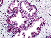 ab118596, at 7.5 µg/ml, staining Suppressor of Fused in formalin fixed, paraffin embedded Human prostate tissue by Immunohistochemistry. 