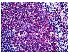 ab118596, at 7.5 µg/ml, staining Suppressor of Fused in formalin fixed, paraffin embedded Human tonsil tissue by Immunohistochemistry.