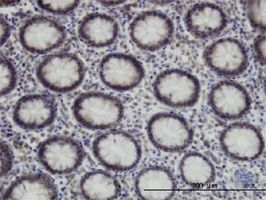 SUPT5H antibody (ab57456) used in immunohistochemistry at 3ug/ml on formalin fixed and paraffin embedded human colon.
