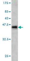 Western blot against tagged recombinant protein immunogen using ab57459 SUR1 antibody at 1ug/ml.