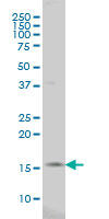 Surb7 antibody (ab56503) at 1ug/lane + HeLa cell lysate at 25ug/lane.