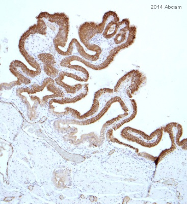 ab17781 staining Surfactant protein D in human gall bladder tissue sections by Immunohistochemistry (IHC-P - paraformaldehyde-fixed, paraffin-embedded sections). Tissue was fixed with formaldehyde, permeabilized with 0.2% Triton X-100 in PBS and blocked with 5% serum for 30 minutes at room temperature; antigen retrieval was by heat mediation in Tris pH 9.0. Samples were incubated with primary antibody (1/400 in PBS) for 16 hours at 4°C. An undiluted Biotin-conjugated horse anti-mouse IgG polyclonal was used as the secondary antibody.See Abreview