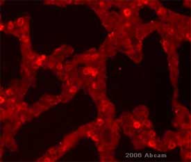 ab17781 at a 1/500 dilution staining perinatal mouse lung tissue sections by Immunohistochemistry (Frozen sections). The tissue was paraformaldehyde fixed and blocked with 2.5% BSA for 30 minutes. The antibody was incubated with the tissue for 16 hours and bound antibody was detected with an Alexa-Fluor ® 594 conjugated Goat anti-Mouse IgG antibody.This image is courtesy of an Anonymous Abreview submitted on 3 April 2006.See Abreview