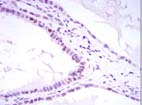 Immunohistochemical analysis of SUZ12 in paraffin embedded Human kidney convoluted tubule tissues, using ab107249 at a 1/200 dilution with DAB staining.