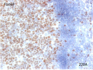 Purified version of ab126577, at 1/500, staining SUZ12 in frozen Human tonsil tissue by Immunohistochemistry.