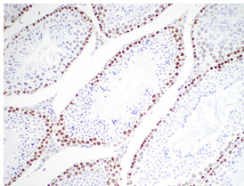 ab126577, at a 1/30 dilution, staining SUZ12 in paraffin embedded Mouse testicle tissue by Immunohistochemistry.