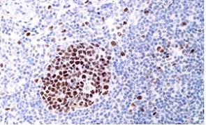 Purified version of ab126577, at a 1/500 dilution, staining SUZ12 in paraffin embedded Human tonsil tissue by Immunohistochemistry.