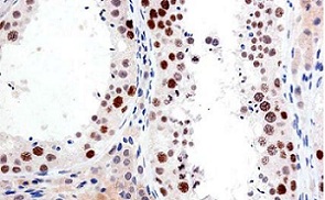 Purified version of ab126577, at a 1/500 dilution, staining SUZ12 in paraffin embedded Human testicle tissue by Immunohistochemistry.