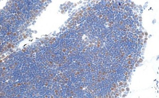 Purified ab126577 at 1/500 staining SUZ12 in paraffin embedded Human thymus tissue by immunohistochemistry.