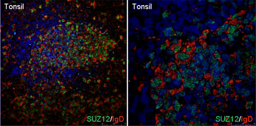 Purified version of ab126577, at a 1/100 dilution, staining SUZ12 (green) in Human tonsil by Immunofluorescence. IgD antibody (red) was used at 1/50. After antigen retrieval (Tris-EDTA buffer), the slides were incubated for one hour at room temperature in a humid chamber with primary antibodies. Slides were then washed in PBS 0.5%-Tween20 3 times for 5 minutes each. The slides were incubated for 1 hour with fluorochrome-conjugated antibodies against the different Ig isotypes, diluted in PBS (dilution 1/200) in a humid chamber in the dark. Subsequently, slides were washed in PBS 0.5% Tween20 3 times for 5 minutes each. Following washing, antifading was added.