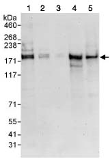 All lanes : Anti-SIK3 antibody (ab88495) at 0.4 µg/mlLane 1 : HeLa cell lysate at 50 µgLane 2 : HeLa cell lysate at 15 µgLane 3 : HeLa cell lysate at 5 µgLane 4 : 293T cell lysate at 50 µgLane 5 : NIH3T3 cell lysate at 50 µg