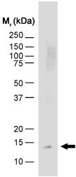 Anti-Synaptobrevin antibody [SP11] (ab11104) + Human brain extractSecondaryF(ab')2 Rabbit anti mouse IgG:HRP