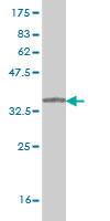 Western blot against tagged recombinant protein immunogen using ab56467 Synaptogyrin 2 antibody at 1ug/ml.
