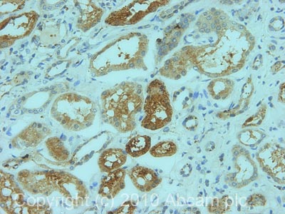IHC image of SLC1A5 staining in human normal kidney formalin fixed paraffin embedded tissue section, performed on a Leica BondTM system using the standard protocol F. The section was pre-treated using heat mediated antigen retrieval with sodium citrate buffer (pH6, epitope retrieval solution 1) for 20 mins. The section was then incubated with ab84903, 5µg/ml, for 15 mins at room temperature and detected using an HRP conjugated compact polymer system. DAB was used as the chromogen. The section was then counterstained with haematoxylin and mounted with DPX.