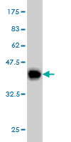 Western blot against tagged recombinant protein immunogen using ab56410 Synaptojanin 2 antibody at 1ug/ml.
