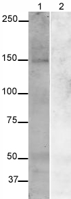 All lanes : Anti-Synaptojanin antibody - Synaptic Marker (ab19904) at 1 µg/mlLane 1 : Rat Brain lysateLane 2 : Rat Brain lysate with Rat Synaptojanin peptide (ab20433) at 1 µg/mlLysates/proteins at 20 µg per lane.SecondaryAlexa Fluor Rabbit polyclonal to Goat IgG at 1/5000 dilutionPerformed under reducing conditions.