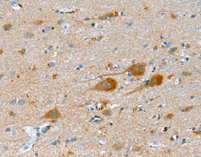 IHC image of Synaptophysin staining in human cerebral cortex FFPE section, performed on a BondTM system using the standard protocol F. The section was pre-treated using heat mediated antigen retrieval with sodium citrate buffer (pH6, epitope retrieval solution 1) for 20 mins. The section was then incubated with ab23754, 1µg/ml, for 15 mins at room temperature and detected using an HRP conjugated compact polymer system. DAB was used as the chromogen. The section was then counterstained with haematoxylin and mounted with DPX.