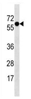 Anti-Synaptotagmin 4 antibody - N-terminal (ab139060) at 1/100 dilution + A2058 cell line lysates at 35 µg